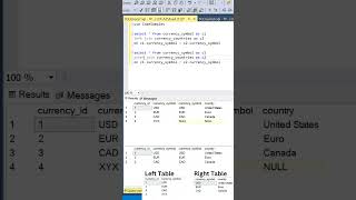 #SQL Left Join vs Inner Join Difference.  #datascience #programming #coding #sqltutorial