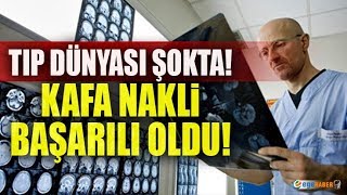 KAFA NAKLİ İLK KEZ GERÇEKLEŞTİRİLDİ !