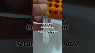 Serum separating tube | clot activator tube | yellow top Tube | SST | blood collection vacutainer