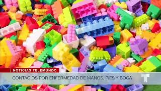 Alertan sobre casos de la enfermedad de manos, pies y boca