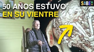 Escondió un secreto en su vientre por 50 años 😨 #curiosidades