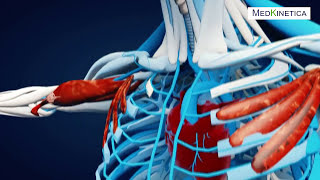 Kinetotarapeutul Potapenco Roman ne vorbeste despre Durerile de Spate si de Herniile de Disc