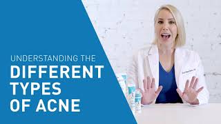 Understanding the Different Types of Acne | CeraVe Skincare