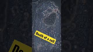 Cell death #cell #celldeath #science #cellinmicroscope #microscope #biology #humancell #cell #viral