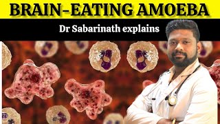 Kerala teen dies of brain-eating amoeba infection|Dr Sabarinath Ravichandar MD DNB pulmonologist|