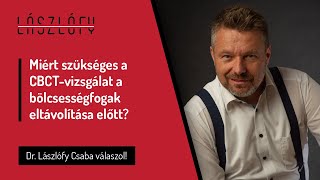 Bölcsességfog és CBCT - miért szükséges a CBCT-vizsgálat a bölcsességfogak eltávolítása előtt?