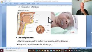 Paediatric Surgery in Arabic 3 (Esophageal Anomalies ) , by Dr. Wahdan