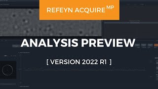 AcquireMP (Version R1) 2022 | Analysis Preview