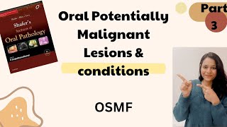 Oral Submucous Fibrosis || Oral Potentially Malignant Lesions & Conditions || Oral Path || Part 2