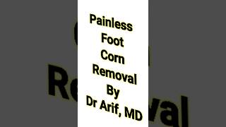 Get rid of painful foot corn @DrArifMDDermatologist #corn #corntreatment