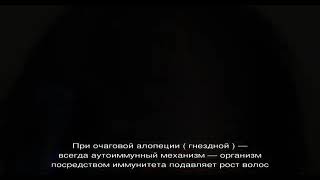 Очаговая алопеция, как быстро лечить?