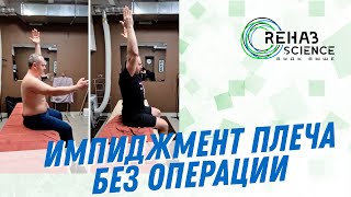 Импиджмент плеча. Реабилитация без операции.