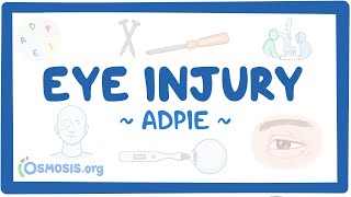 Eye injury: Nursing Process (ADPIE)