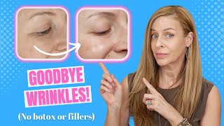 ELIMINATE Wrinkles & Crows Feet In Minutes Per Day! | No Botox, Fillers | Nira At Home Laser Review