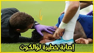 عاجل.. إصابة خطيرة لوالكوت في مباراة إيفرتون ومانشستر سيتي Walcott Injury