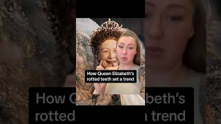 How Queen Elizabeth’s rotted teeth 😳🦷 set a trend