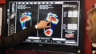 Custom Foot Analysis for Foot Problems