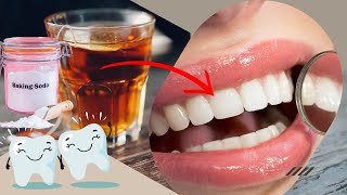 How to Make Teeth White - 17 Effective Ways to Remove Plaque Naturally