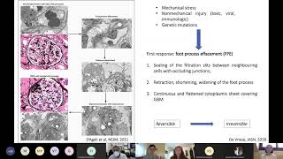 Glomerulosclerosi Focale Segmentale (GSFS): il ruolo dei test genetici nel processo diagnostico