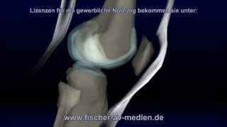 Das Knie - kurz und bündig - 3d Animation - Knee - Anatomie