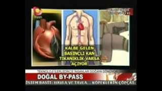 EECP ile Doğal Bypass (Flash TV) Prof Dr Günsel Avcı