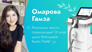 Отзыв от Гамзы Омаровой / Диодный лазер для эпиляции Wingderm