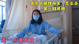 女子在上海查出骨癌治了2年，没想到接下来还有更大的病情等着她