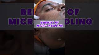 Are you ready to take your skin from ok to AMAZING? #microneedling #tamilbeautycare