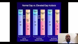 Anion Gap Dr.Mohammed Hassanien