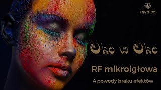 Oko w oko z radiofrekwencją mikroigłową - 4 powody braku efektów | L'Experta