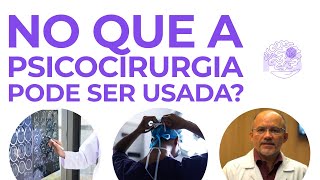 Quais as Aplicações da Psicocirurgia? Neurocirurgião Explica.