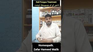 #drzafarhameedmalik #nails #fungus #fungustreatment #nail #homeopathy #homeopathic #trending