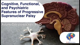 Cognitive, Functional, and Psychiatric Features of Progressive Supranuclear Palsy