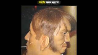 कभी देखा है दो चेहरे वाला इंसान,  😱 amazing fact   edward _ top viral fact _basudev pramanik#short