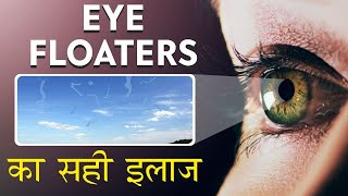 Eye Floaters: The Hidden Danger You Need to Know About! 👁️