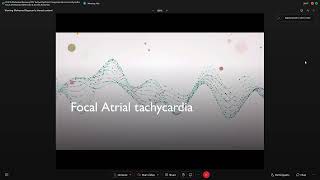 nappropriate sinus tachycardiarocal Atrial tachycardia - Mohamed Bayoumi-