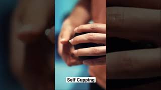 Self Cupping Device For Back Pain Relief #cuppingtherapy #backpainrelief #achedaway #massager