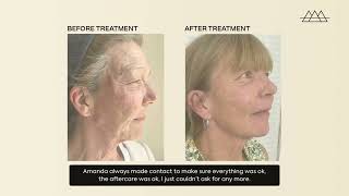 Start your ageing journey with Amanda