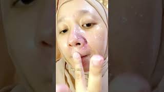 Daki Langsung Rontok Muka Jadi Glowing Banget #shorts #beautyhacks #shortvideo