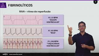 Tratamento da Síndrome Coronária com Supra ST