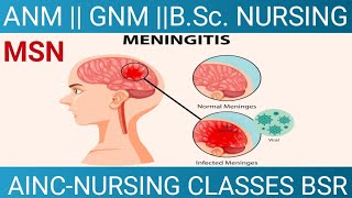 Meningitis ||  Inflammation of Meninges || MSN|| BSc.N ||GNM||