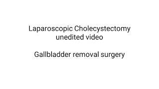 Laparoscopic Cholecystectomy (unedited video for learning) | Gallbladder removal surgery