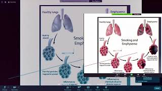 Webinar on Concerning Causes of Lung Cancer 2021