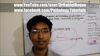 Thrombosis : Definition, Pathogenesis, Morphology & Fate (HD)