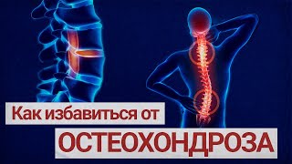 Избавляемся от боли в спине и шее / Лечение остеохондроза