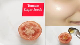 *DIY Tomato Sugar Scrub for Glowing skin*/Remove Dead Skin  मृत त्वचा से पाय छुटकारा - YouTube