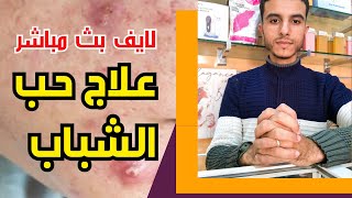 لايف بث مباشر علاج حب الشباب وأثاره وما هي أسباب ضهوره وإجابة على أسئلتكم