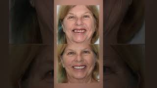 Cancer-Survivor Testimonial - Comprehensive Dentistry at Midtown Dental Sacramento