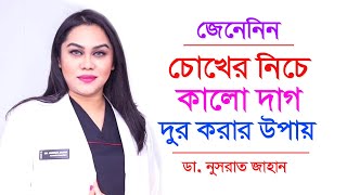 চোখের নিচের কালো দাগ দূর করার উপায় | ডা. নুসরাত জাহান | Remove Dark Circles Beauty Tips