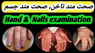 physical examination of hand